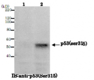MAB0660 - TP53 / p53