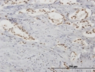 MAB0660 - TP53 / p53