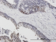 MAB0660 - TP53 / p53