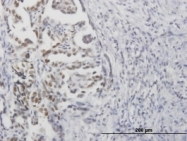 MAB0660 - TP53 / p53