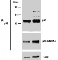 MAB0661 - TP53 / p53
