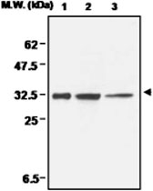 MAB0682 - CCS / SOD4
