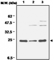 MAB0689 - Superoxide dismutase 2 / SOD2