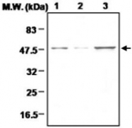 MAB0691 - Ferredoxin reductase