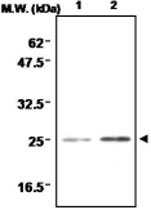 MAB0692 - Superoxide dismutase 2 / SOD2