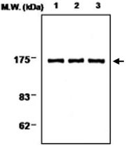 MAB0700 - PLCG1