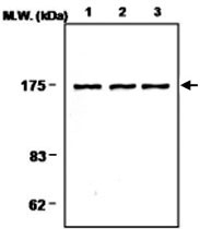 MAB0701 - PLCG1