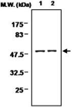 MAB0702 - PTPN1