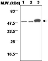 MAB0709 - Neuron specific enolase