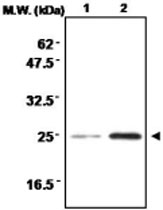 MAB0710 - Superoxide dismutase 2 / SOD2