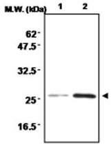 MAB0711 - Superoxide dismutase 2 / SOD2