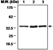 MAB0722 - SULT1A3/1A4