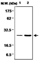 MAB0731 - Glutathione peroxidase 1 / GPX1