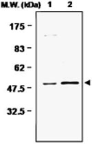MAB0734 - Glutamine synthetase
