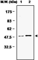 MAB0735 - Glutamine synthetase