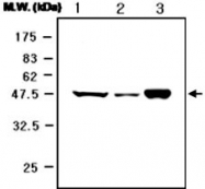 MAB0736 - Neuron specific enolase