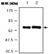 MAB0742 - Albumin