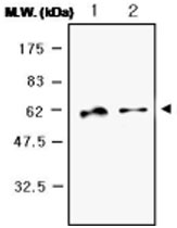 MAB0743 - SERPINC1 / Antithrombin-III