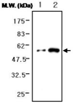 MAB0744 - Fibrinogen