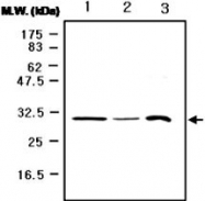 MAB0747 - CDK5