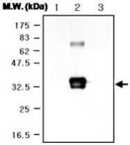 MAB0749 - Superoxide Dismutase 3 / SOD3
