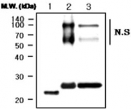 MAB0751 - Apolipoprotein A I / APO AI