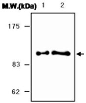 MAB0756 - SERPING1 / C1 Inhibitor