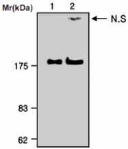 MAB0757 - Alpha-2-macroglobulin / A2M