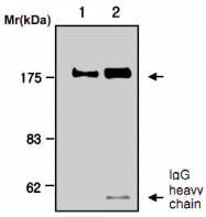 MAB0758 - Alpha-2-macroglobulin / A2M