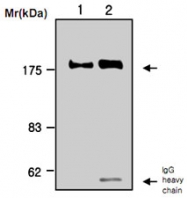 MAB0759 - Alpha-2-macroglobulin / A2M