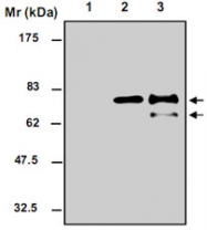 MAB0760 - Chromogranin A