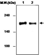 MAB0766 - Attractin
