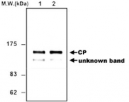 MAB0777 - Ceruloplasmin