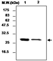 MAB0778 - Serum amyloid P-component