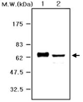 MAB0779 - Alpha-1-antichymotrypsin / ACT