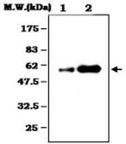 MAB0785 - Alpha-1-antitrypsin
