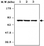 MAB0798 - BTK