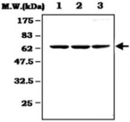 MAB0801 - PLK1