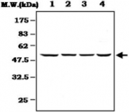 MAB0802 - MAPKAP Kinase-5