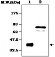 MAB0808 - Vitronectin
