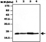 MAB0810 - BID