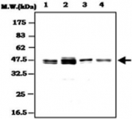 MAB0811 - TARBP2