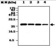 MAB0817 - Casein kinase II beta