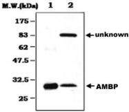 MAB0820 - AMBP