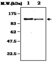 MAB0824 - Complement C6