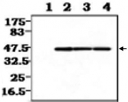 MAB0825 - CKBB
