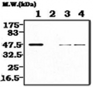 MAB0827 - CKMM