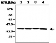 MAB0830 - CDK7