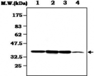 MAB0831 - CDK7