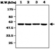 MAB0833 - MKNK1